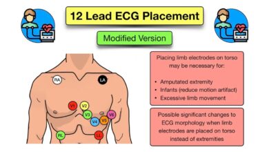 leads for ekg